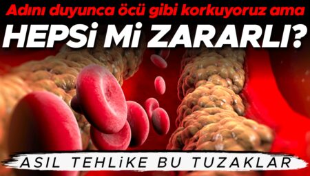 İsmini duyunca öcü üzere korkuyoruz lakin… Kolesterol zengini tüm besinler ziyanlı mı? Yüksek kolesterol içeren hangi yiyeceklerden kaçınmalıyız?