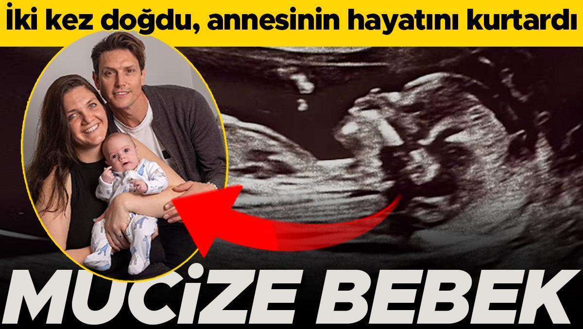 Mucize bebek! İki defa doğdu, annesinin hayatını kurtardı