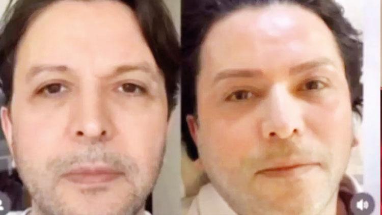 Son hali gündem oldu: Nihat yeni doğan!