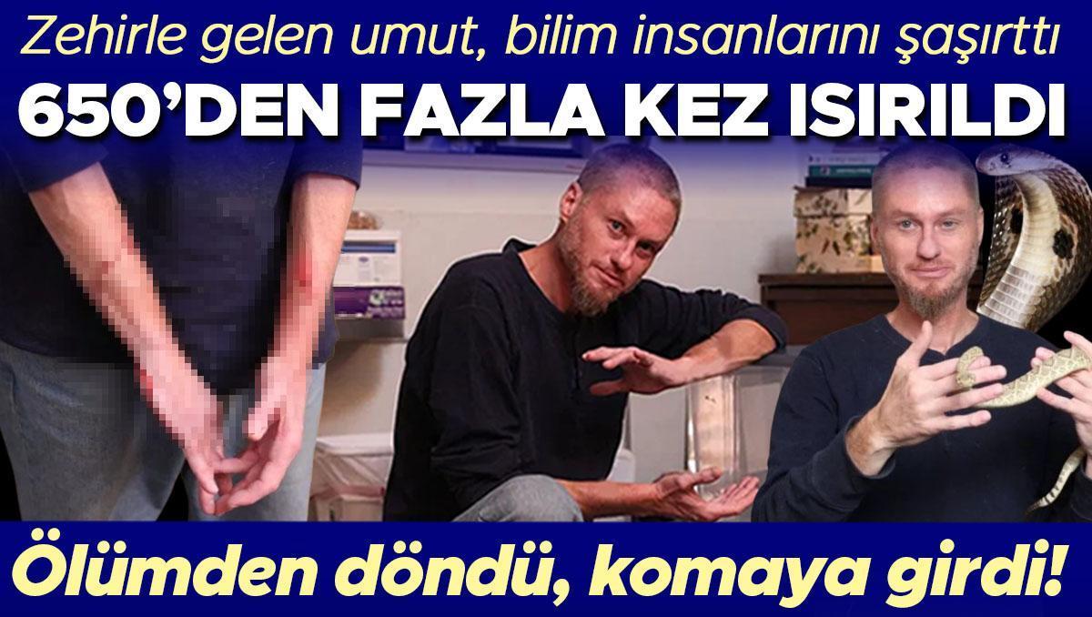 Zehirle gelen umut! Bilim insanlarını şaşırttı, 650’den fazla kere ısırıldı! ‘Yıllardır bunu bekliyordum, şahane bir duygu’