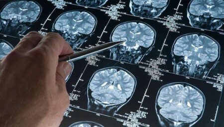 Alzheimer’da yeni umut: Erken evrede teşhisi mümkün kılacak kan testi ABD’de onaylandı