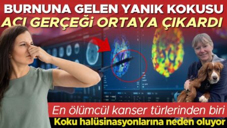 Bir gün burnuna yanık kokusu geldi ve hayatı altüst oldu | Halbuki hayali kokular o ölümcül hastalığın belirtisiymiş