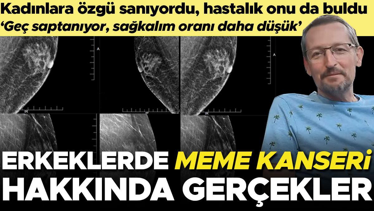 Bu hastalık bayanlara has sanıyordu, hiç beklemediği anda onu da buldu! Erkeklerde göğüs kanseri hakkındaki gerçekler… ‘Geç saptanıyor, sağkalım oranı daha düşük’